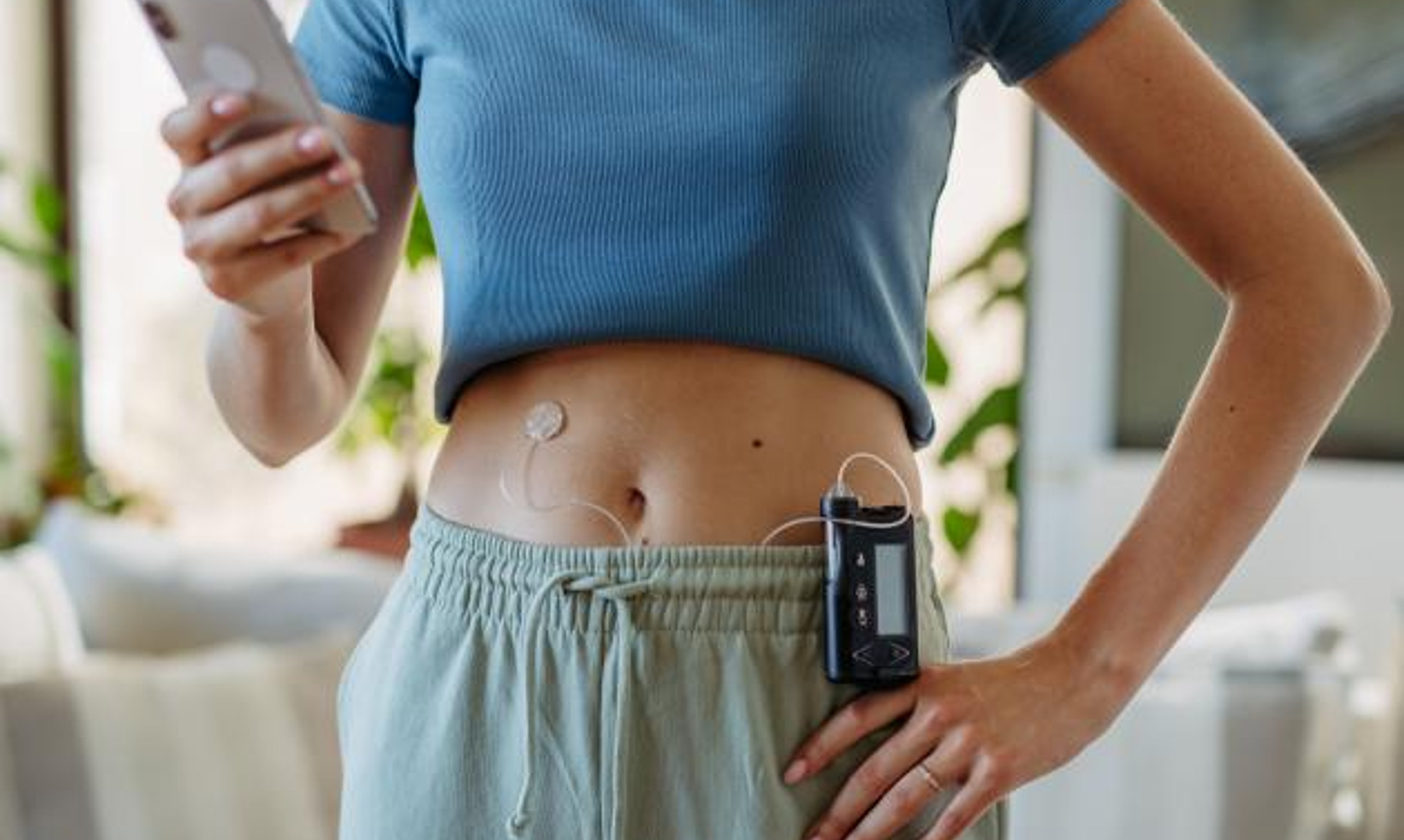 A woman wearing a CGM and insulin pump