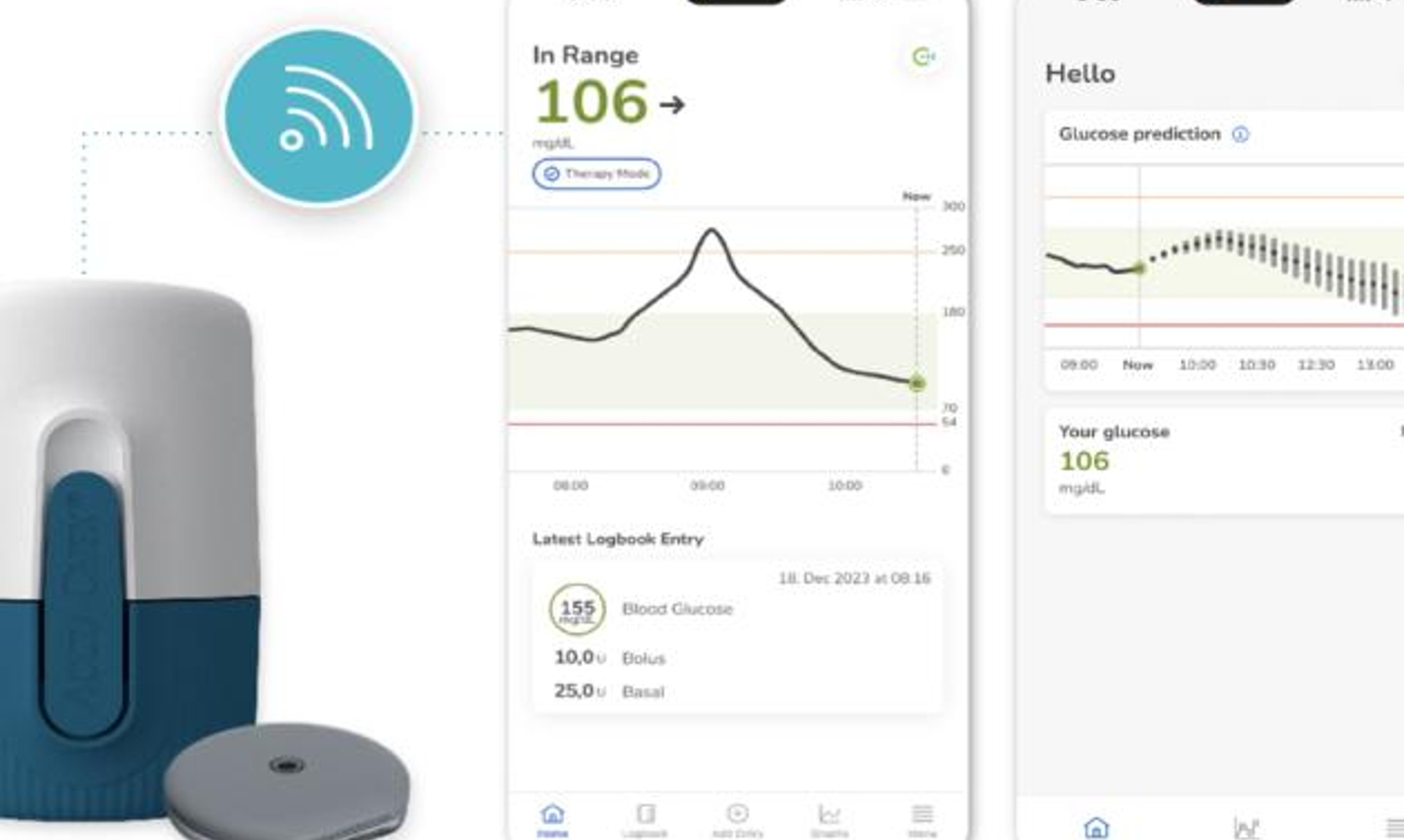 The Accu-Check SmartGuide CGM, showing blood sugar levels plotted on a graph hours into the future.