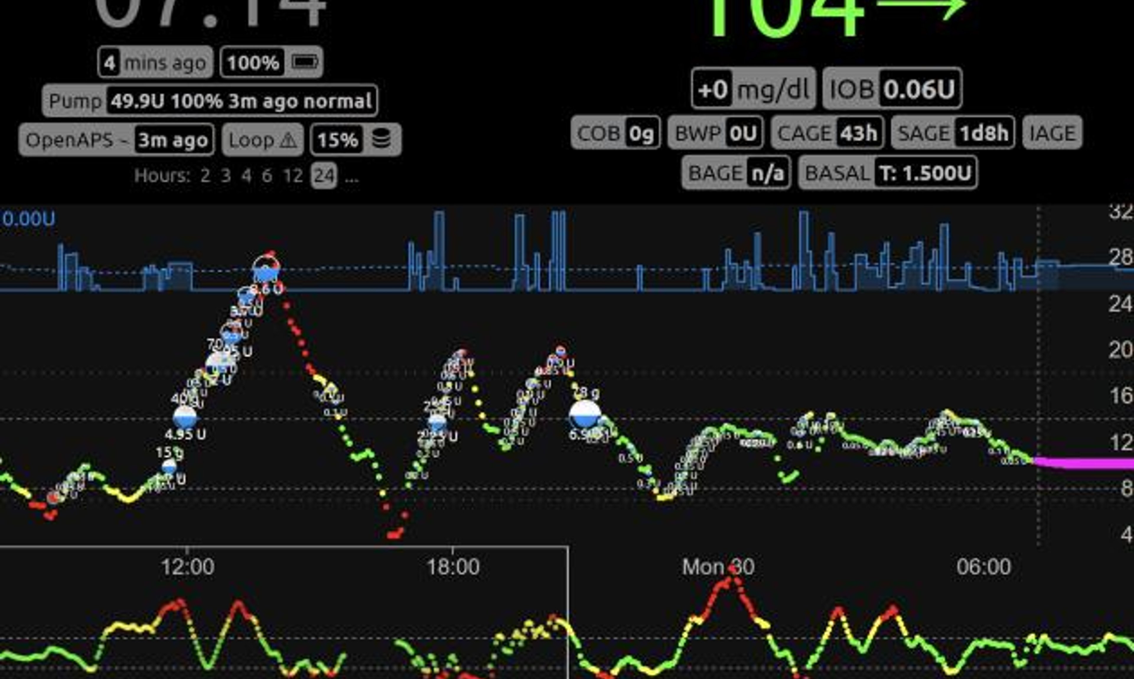 The main interface for Nightscout shows current blood sugar level, insulin dosing, past CGM readings, and other data on a web page.
