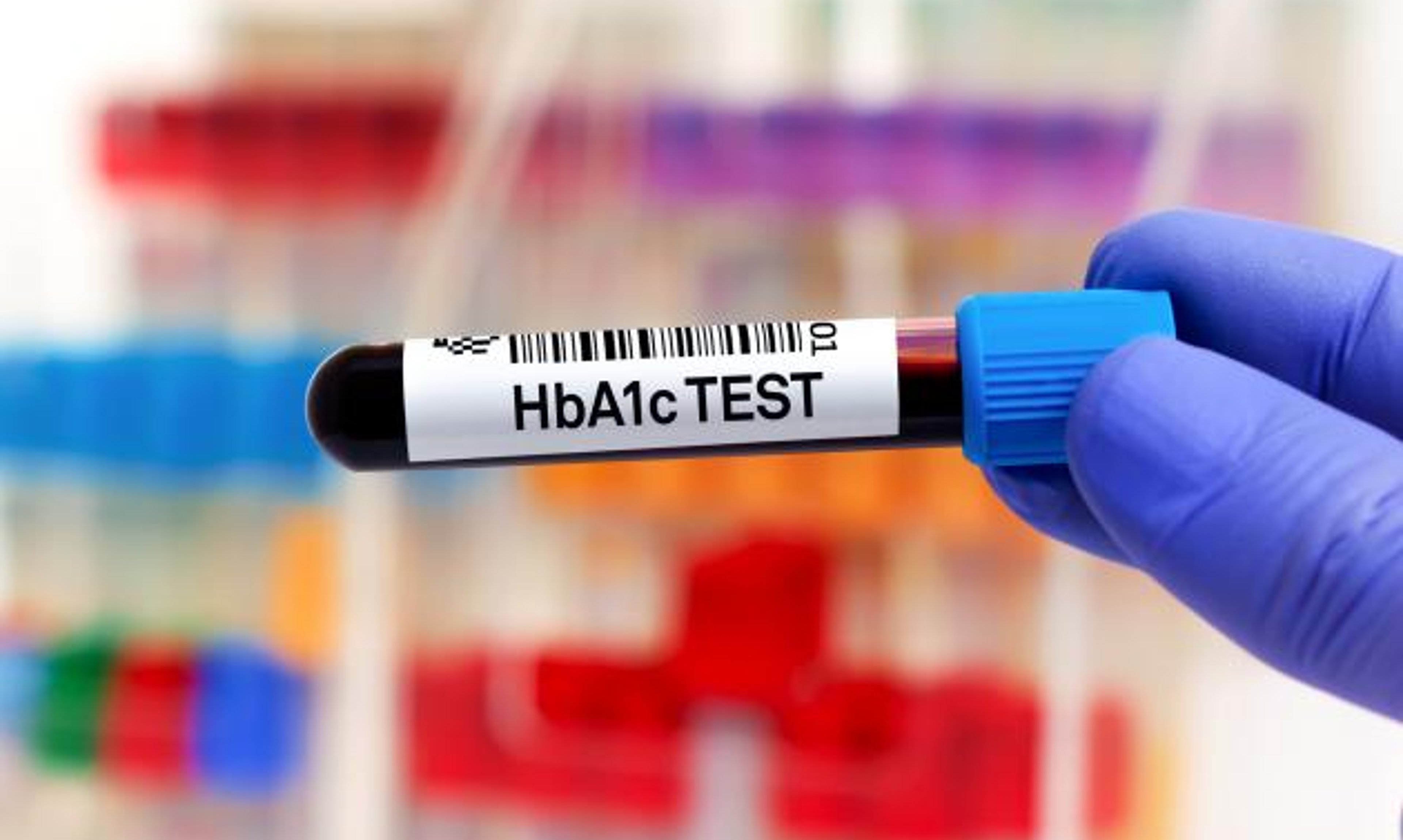 Image of test tube labeled "HbA1c Test"
