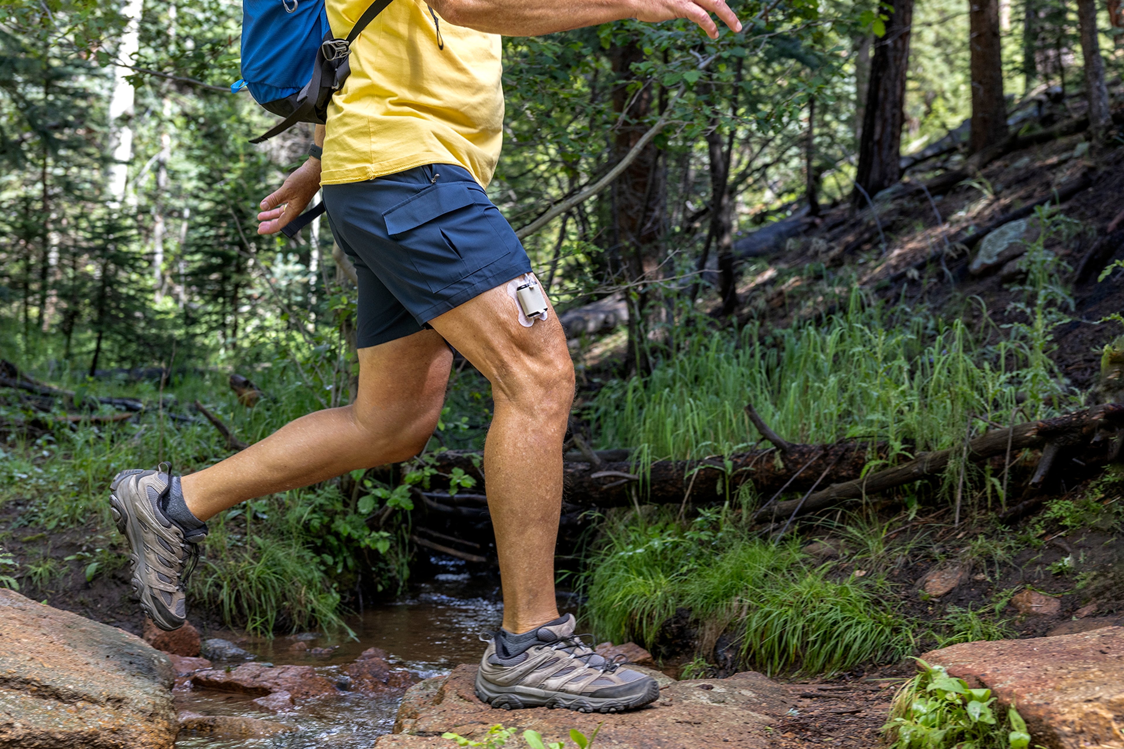 A man jogs on a trail wearing a Tandem Mobi insulin pump on his leg.