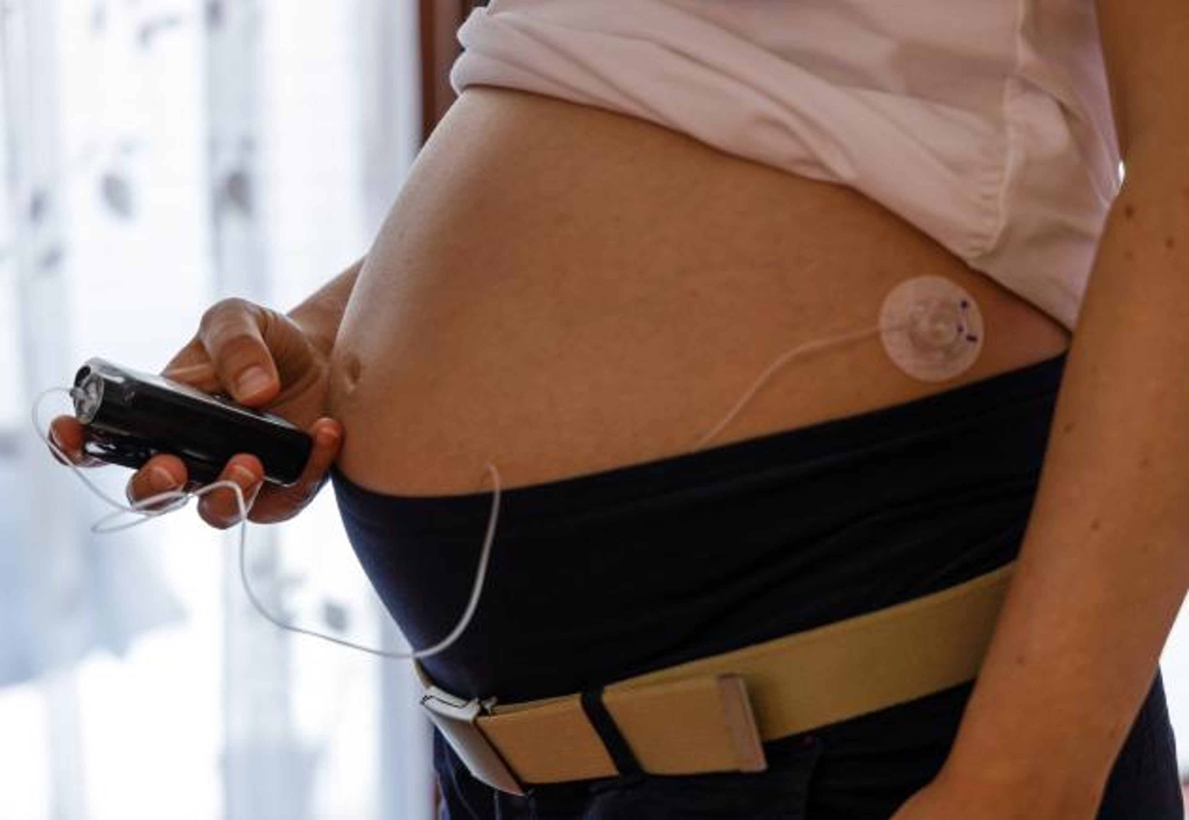 Pregnant woman with insulin pump in hand and infusion set on belly