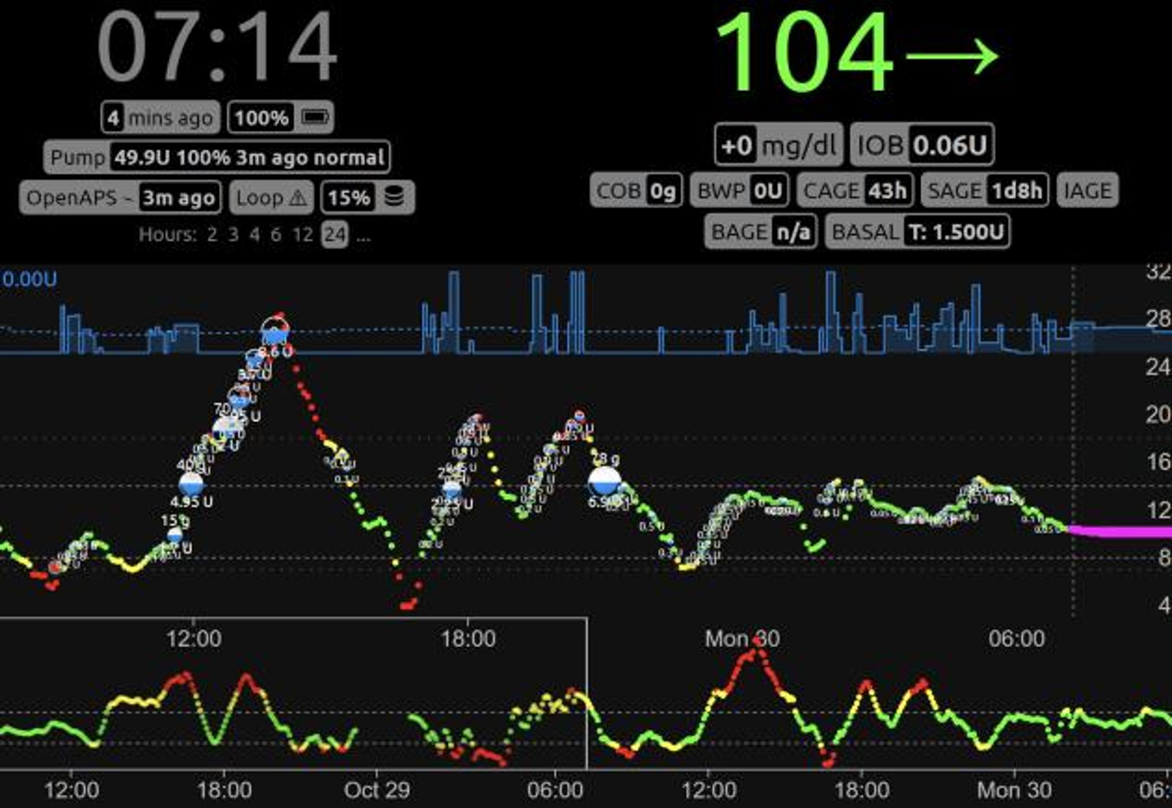The main interface for Nightscout shows current blood sugar level, insulin dosing, past CGM readings, and other data on a web page.