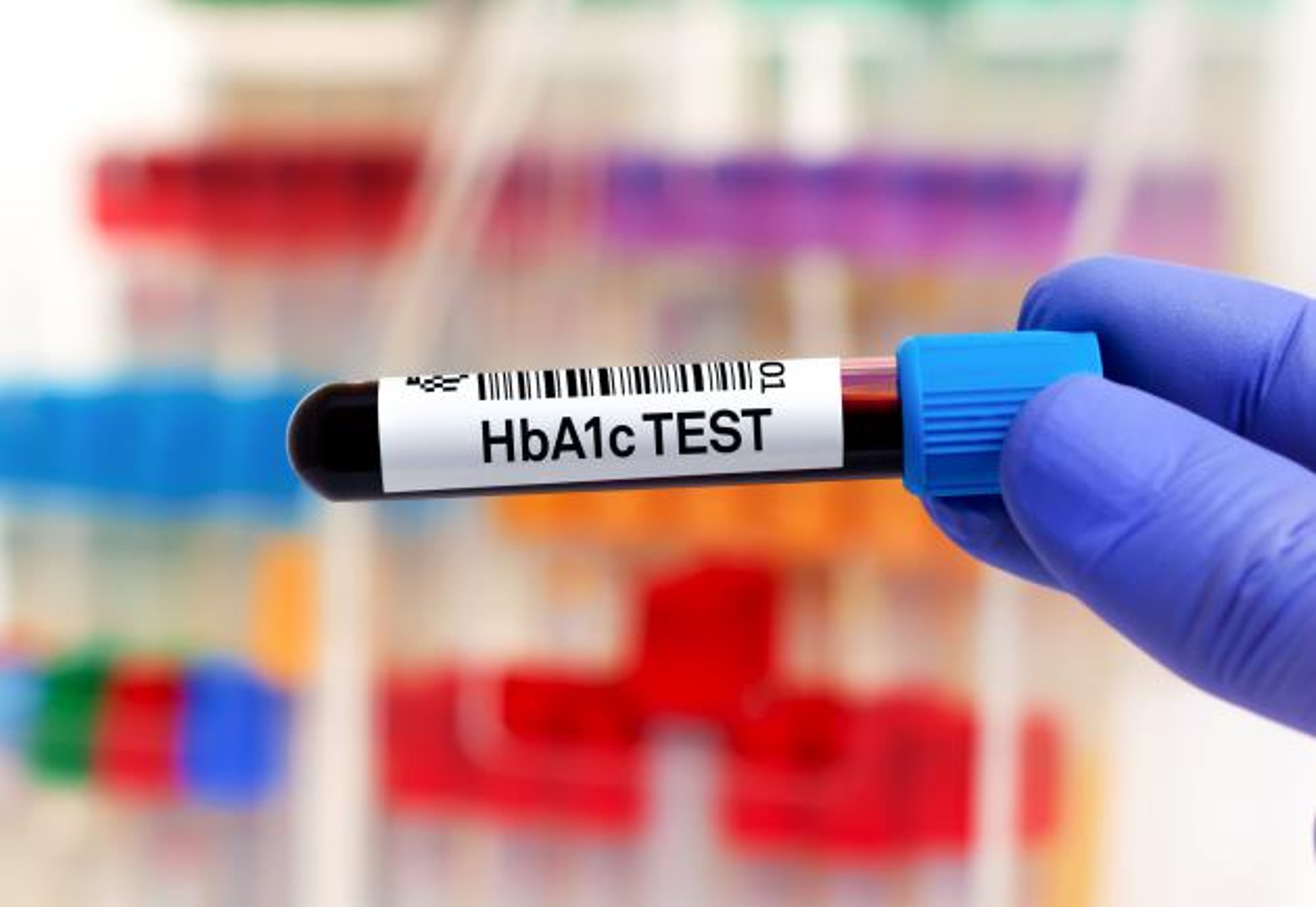 Image of test tube labeled "HbA1c Test"