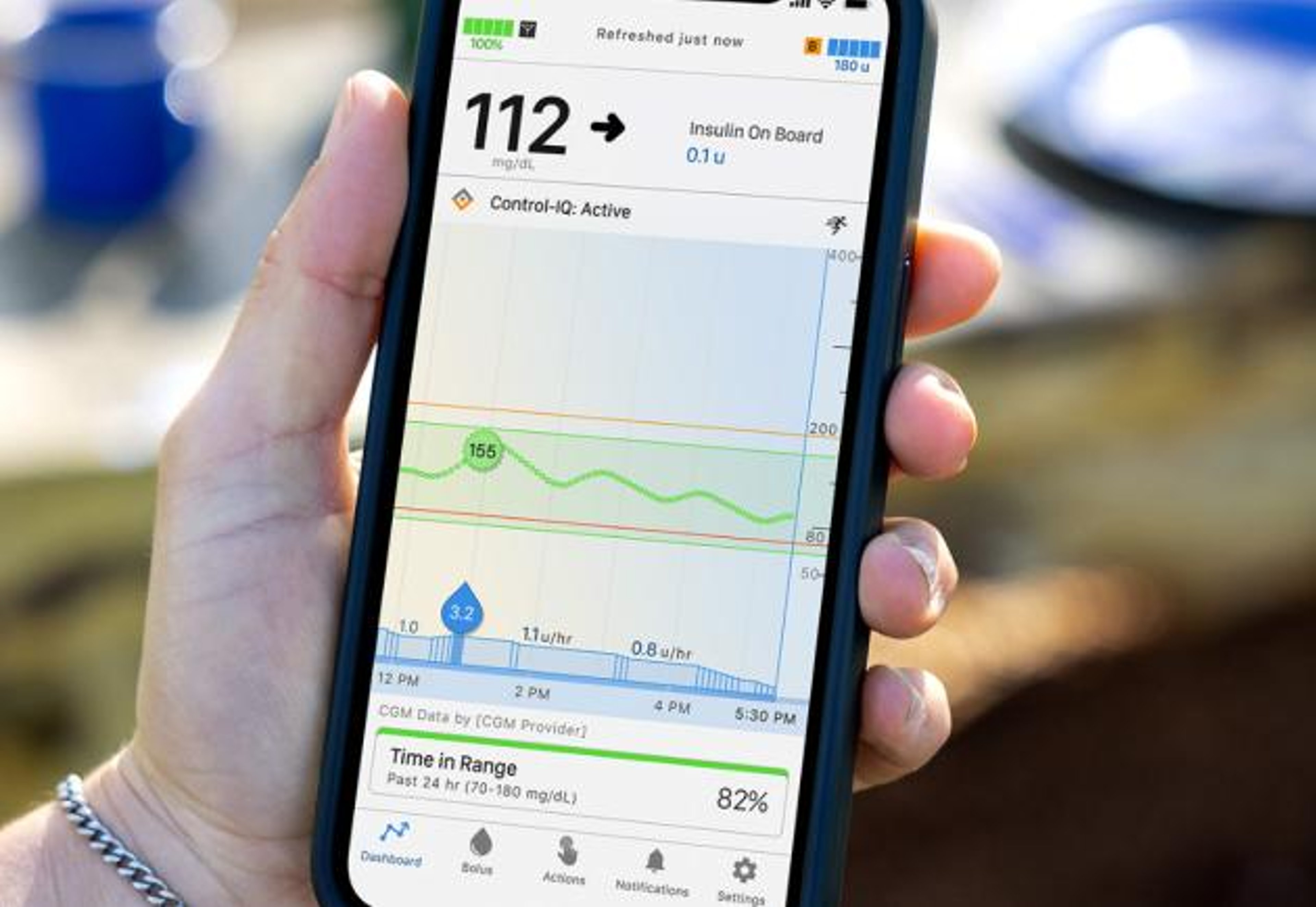 Current Control-IQ display on an iPhone. Tandem is working on a future version of its AID system where no meal announcements are necessary.