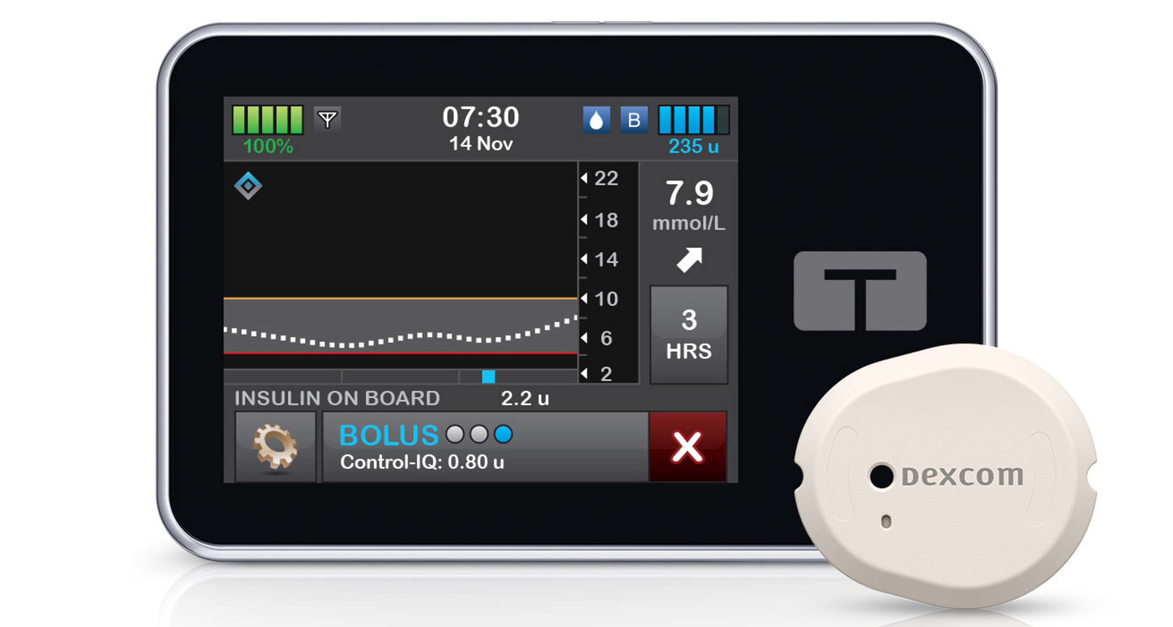 The t:slim X2 and Dexcom G6 CGM sensor