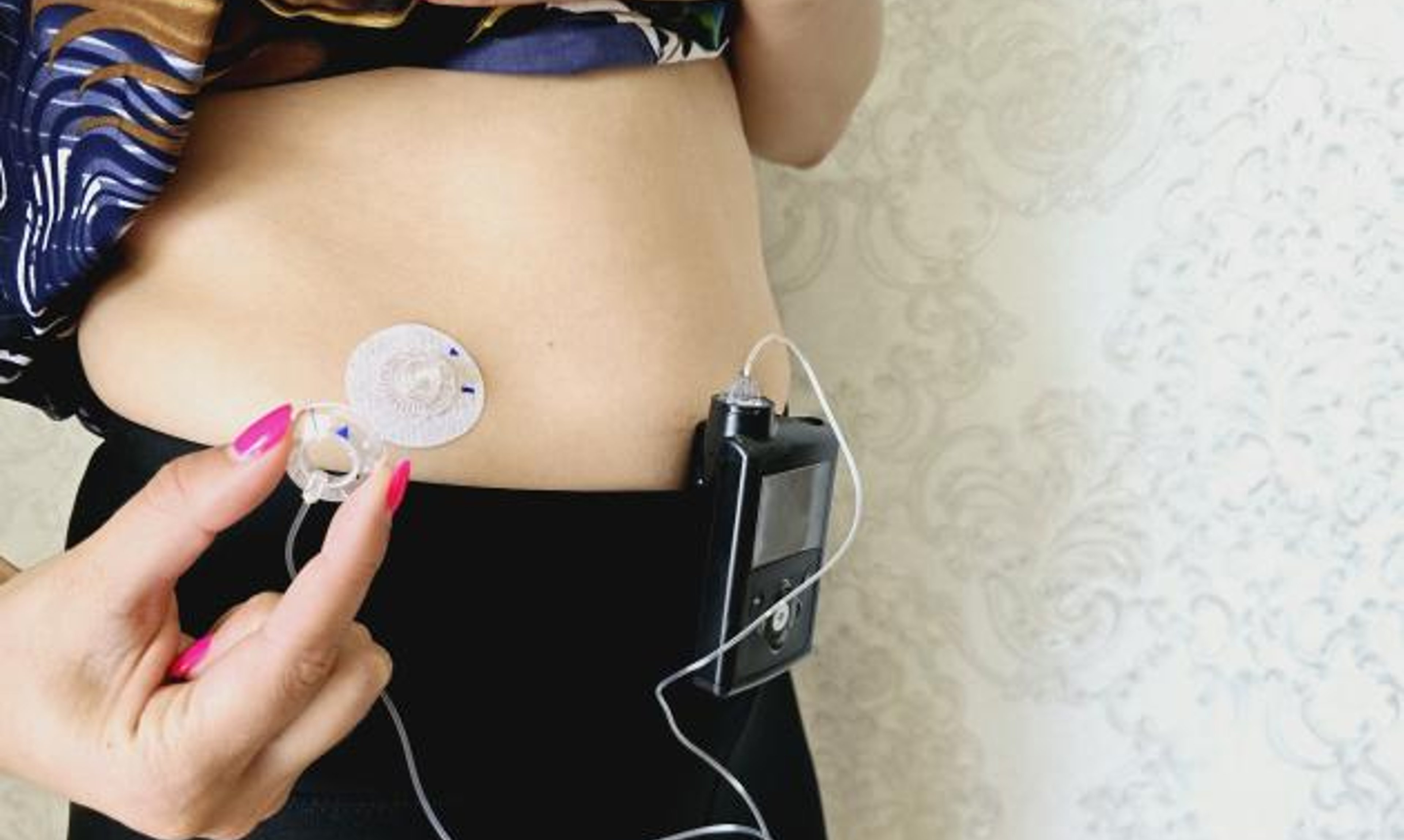 A person with an insulin pump