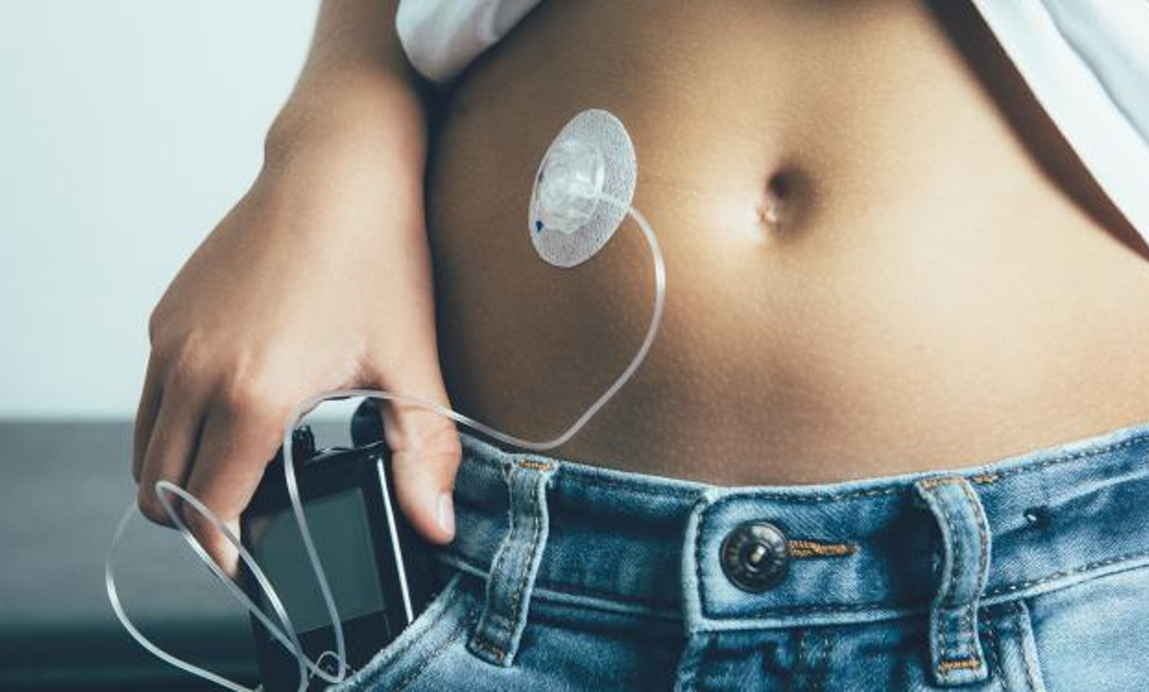 Type 1 Diabetes Overview