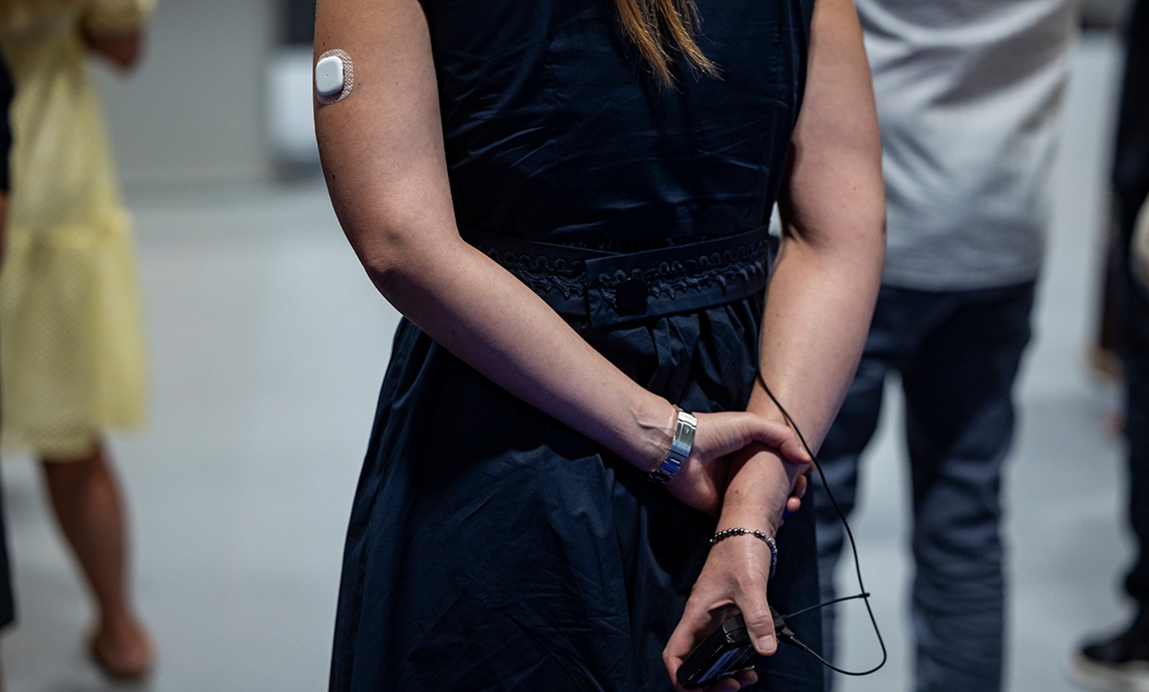 A person attending EASD wearing a CGM sensor
