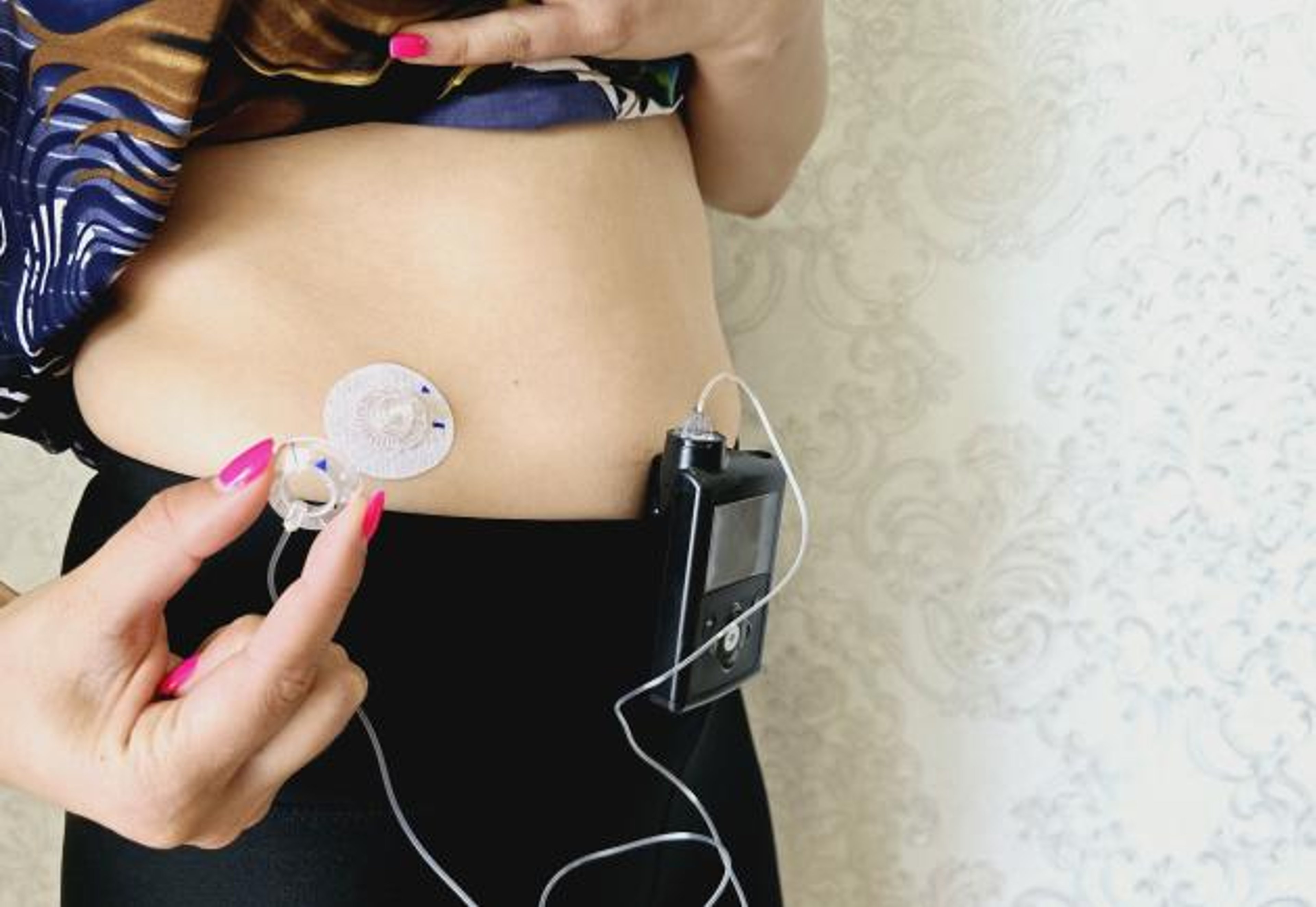 A person with an insulin pump