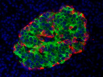 A fluorescent microscope image of insulin producing beta cells in green and the glucagon producing alpha cells in red. (Photo courtesy of Dr. Faoud Kandeel.)