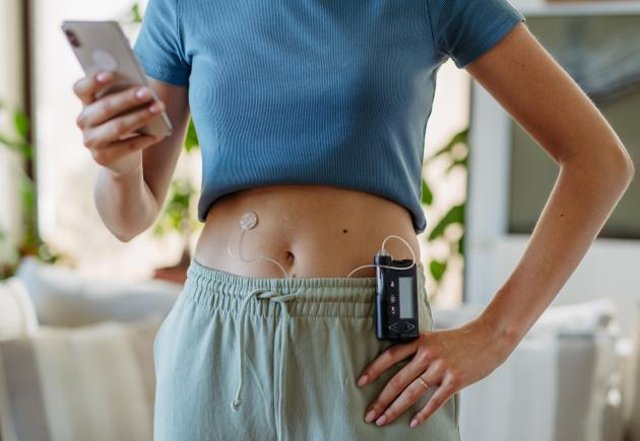 A woman wearing a CGM and insulin pump