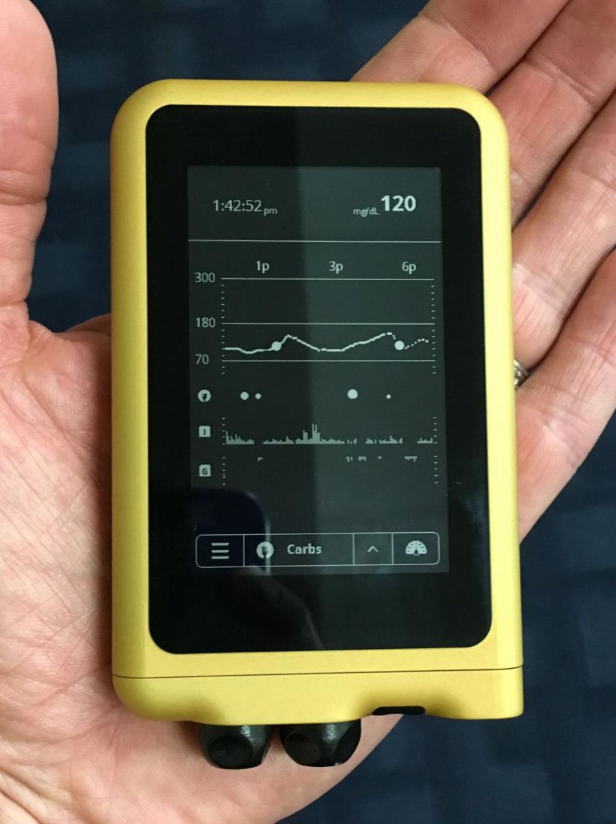 Introducing Beta Bionics Bringing The Ilet Bionic Pancreas To Market