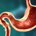 gut and small intestine type 2 diabetes