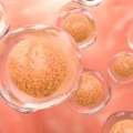 stem cells used for type 1 diabetes