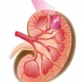 Kidney, chronic kidney disease, nephropathy